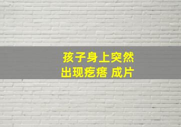 孩子身上突然出现疙瘩 成片